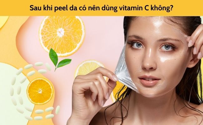 Sau khi peel da có nên dùng vitamin C không?