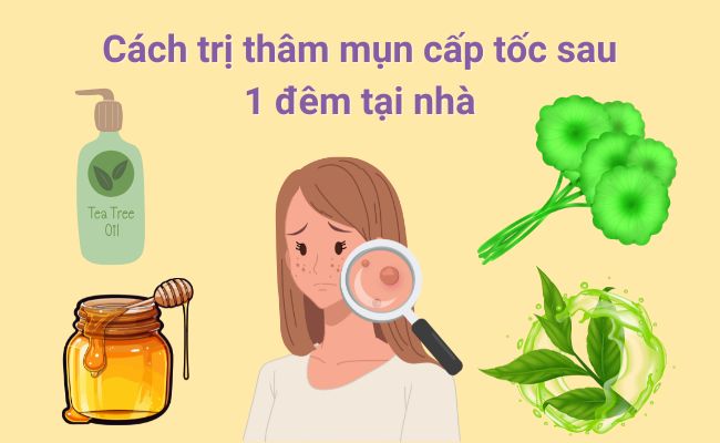 Đánh bay vết thâm mụn nhanh nhất bằng phương pháp tự nhiên