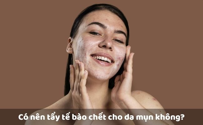 Có nên tẩy tế bào chết cho da mụn không?

