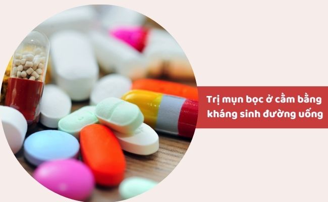 Trị mụn bọc ở cằm bằng liệu pháp y tế
