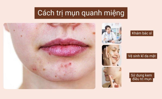 Hướng dẫn cách trị mụn quanh miệng