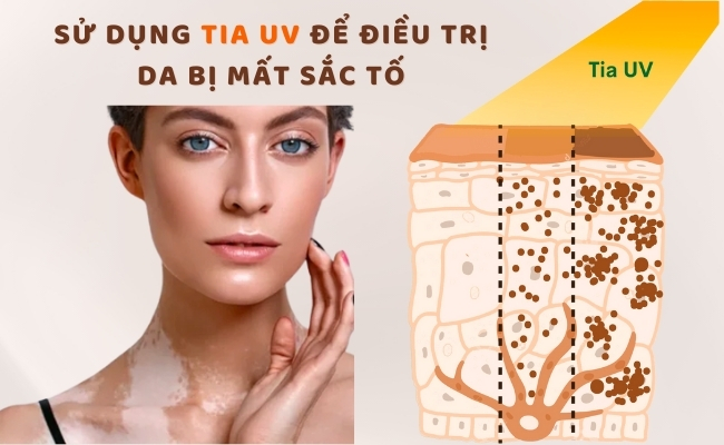 Với các biện pháp phòng ngừa trênbạn có thể kiểm soát chứng tăng sắc tố da.