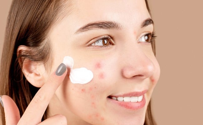 Dùng Niacinamide, AHA và BHA để trị mụn bọc, mụn mủ tại nhà