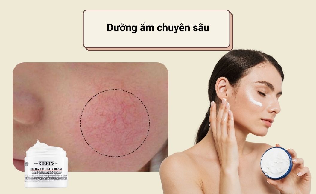 Dưỡng ẩm chuyên sâu với sản phẩm dành riêng cho da nhạy cảm