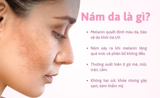 Nám da là gì?