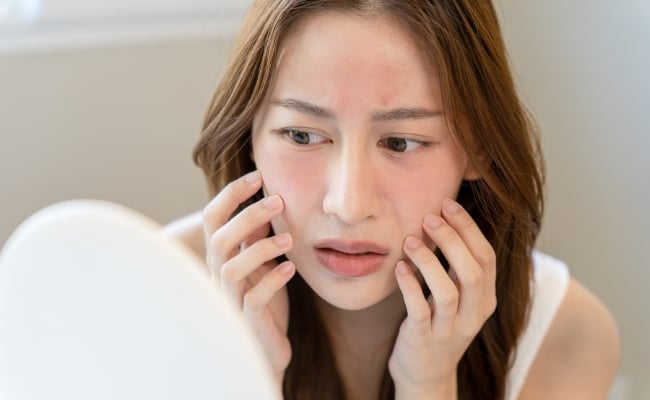 Biểu hiện của làn da nhạy cảm Đặc điểm của da nhạy cảm