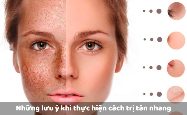 Những lưu ý khi thực hiện cách trị tàn nhang
