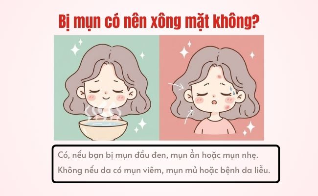 Bị mụn có nên xông mặt không?