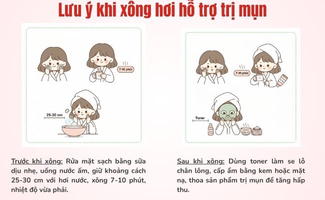 Lưu ý khi xông hơi hỗ trợ trị mụn