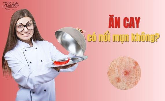 Hình ảnh minh họa về Ăn cay có nổi mụn không?
