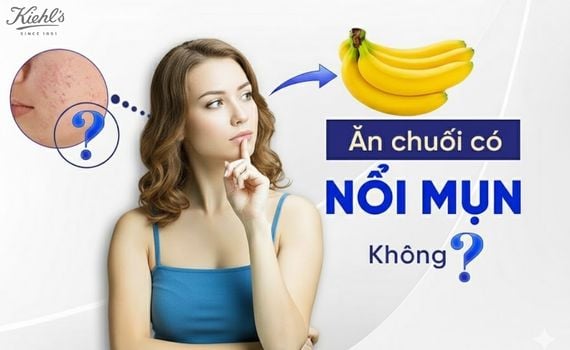 Hình ảnh minh họa về ăn chuối có nổi mụn không