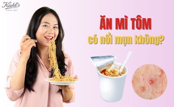 Hình ảnh minh họa về Ăn mì tôm có nổi mụn không