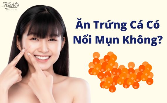 Hình ảnh minh họa về ăn trứng cá có nổi mụn không