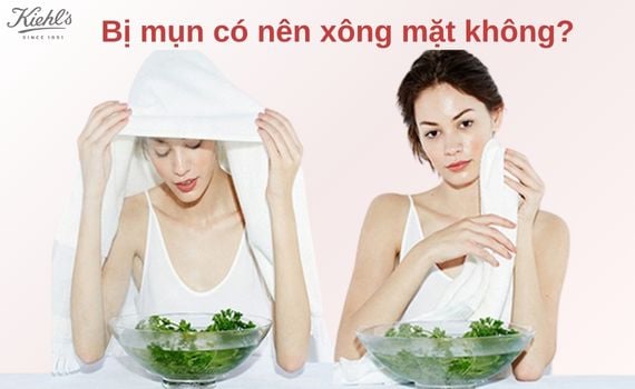 Hình ảnh minh họa về bị mụn có nên xông mặt không