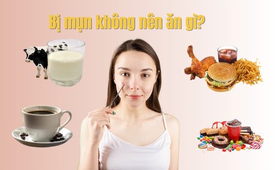 Hình ảnh minh họa về bị mụn không nên ăn gì