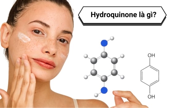 Hình ảnh minh họa về hydroquinone