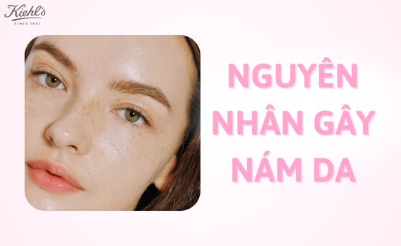 Hình ảnh minh họa về Nguyên nhân gây nám da