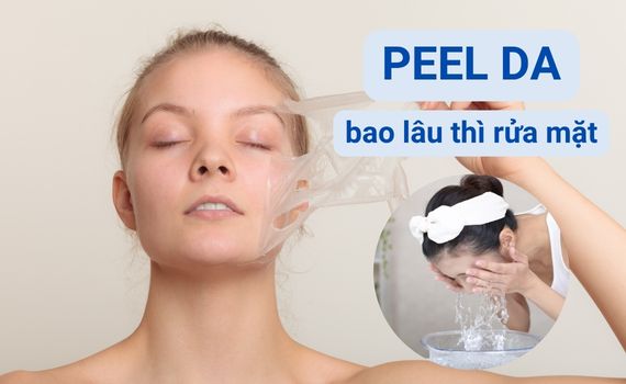 Hình ảnh minh họa về peel da bao lâu thì rửa mặt