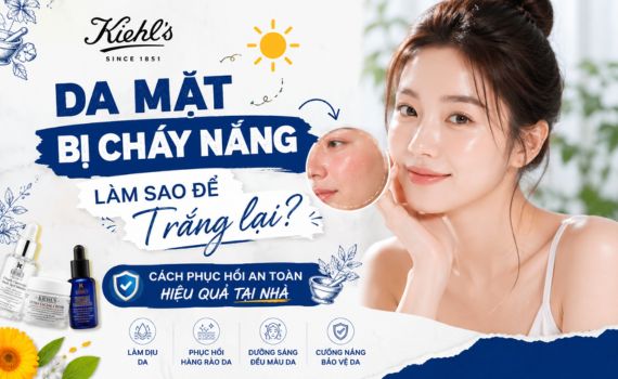 Hình ảnh minh họa về da mặt bị cháy nắng