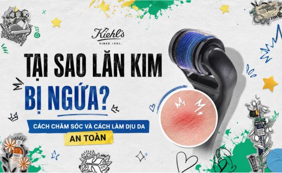 Hình ảnh minh họa về lăn kim bị ngứa